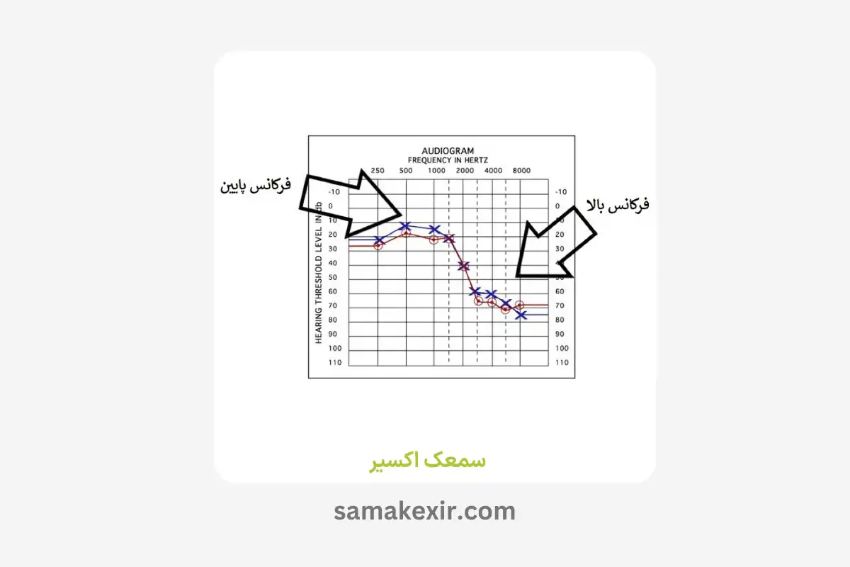 سمعک پشت گوشی نازک (RIC) مناسب چه افرادی است؟