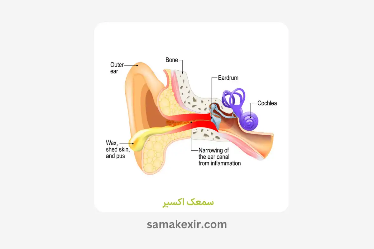 عفونت گوش خارجی چیست؟