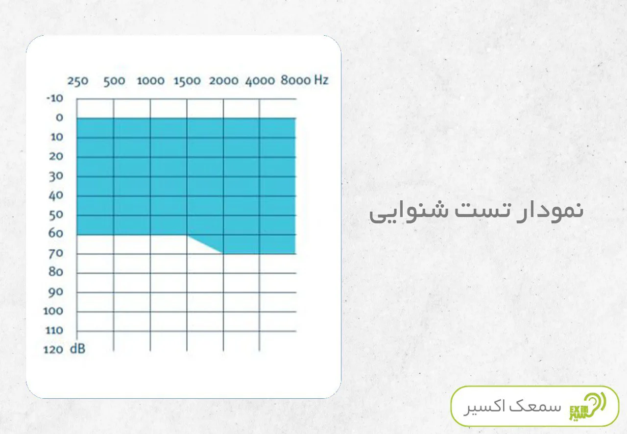 نمودار تست شنوایی