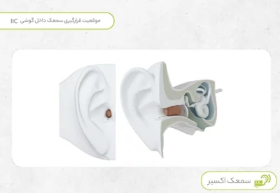 سمعک داخل گوشی iic