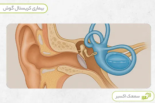 تکان خوردن مایع گوش