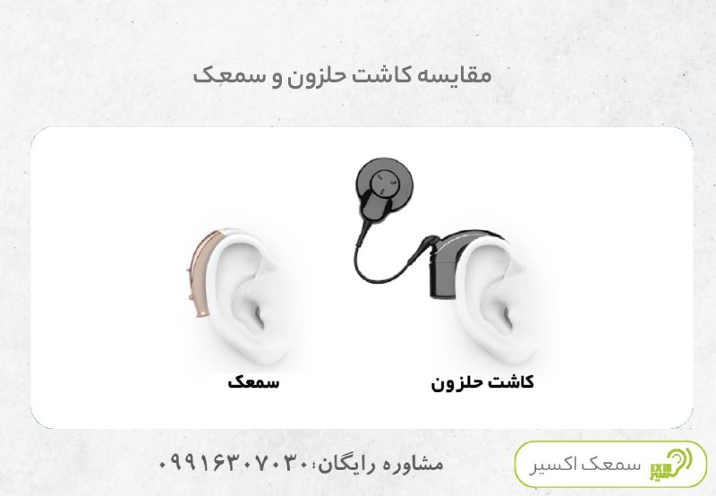 مقایسه کاشت حلزون و سمعک