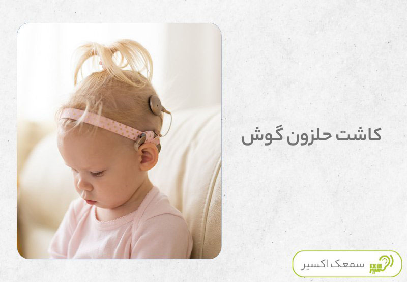 کاشت حلزون برای کودک